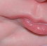 Hamberis et al./BMJ Case Reports - Tdnu.Ru