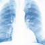 В Башкирии за сутки пневмонией заболели почти 300 человек - ProUral.Info