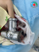 Девочка в Башкирии пострадала от электромясорубки