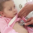 Вернулась домой: 3-летняя девочка, выброшенная из окна своим же папой, закончила курс лечения в Москве - Комсомольская правда